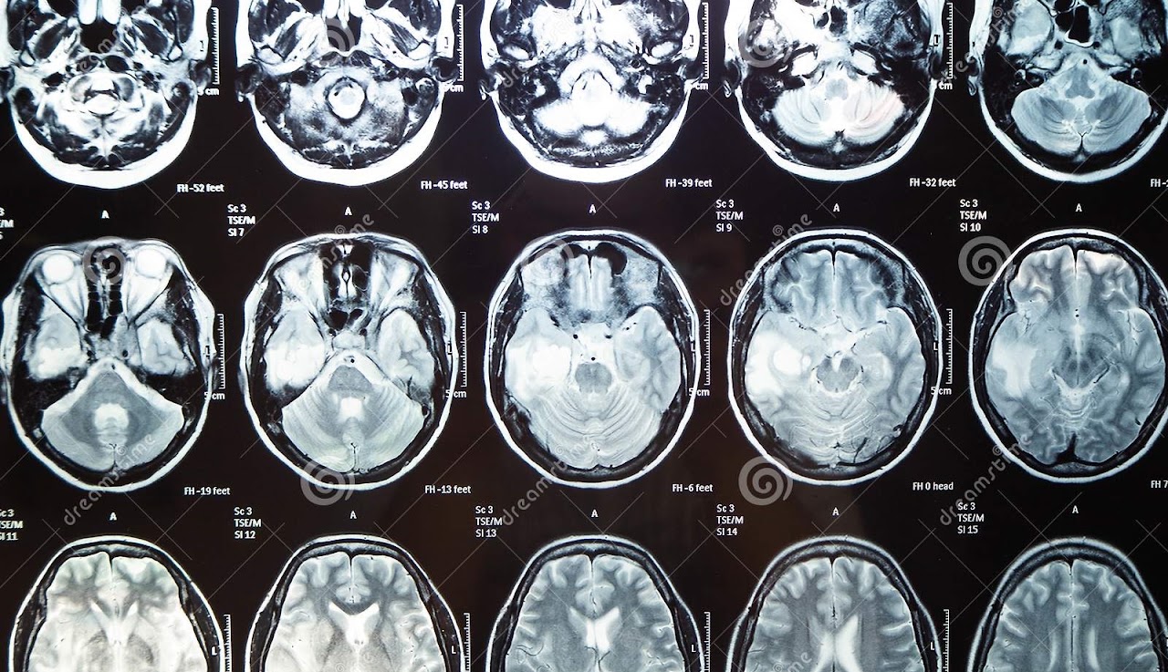 Medtech AI imaging